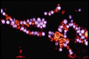 An electron microscope image of the measles virus.