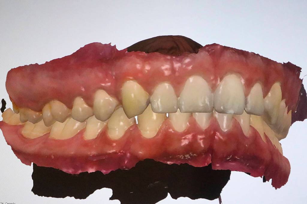 A 3-D scan allows the entire mouth to be seen from all angles, something not possible by having a patient simply open their mouth. Nicole Jennings/staff photo