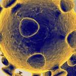 The state coronavirus hotline is dropping calls